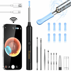 Schnäppchenangebot: VITCOCO WiFi Ohrenreiniger Kamera 📸👂