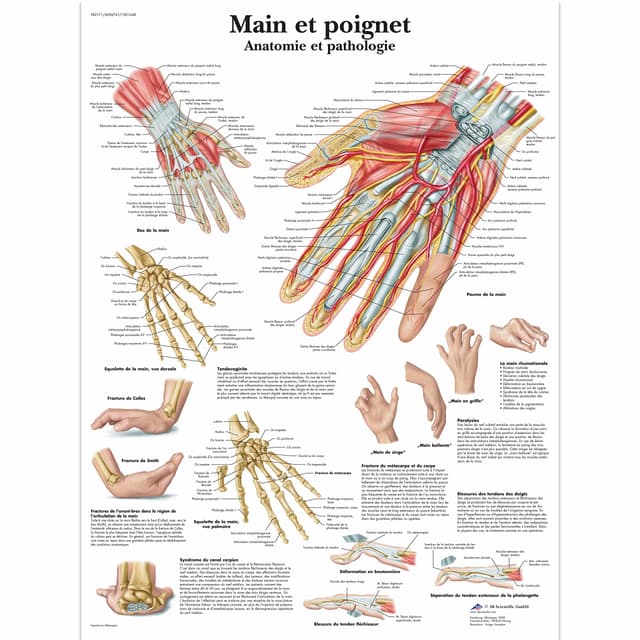 3B Scientific Lehrtaffel - Main et poignet - Französisch Entlastete Hand / Handgelenk