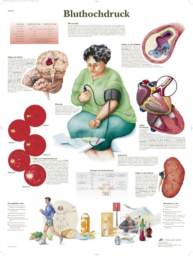 3B Scientific Lehrtafel - Bluthochdruck Papier