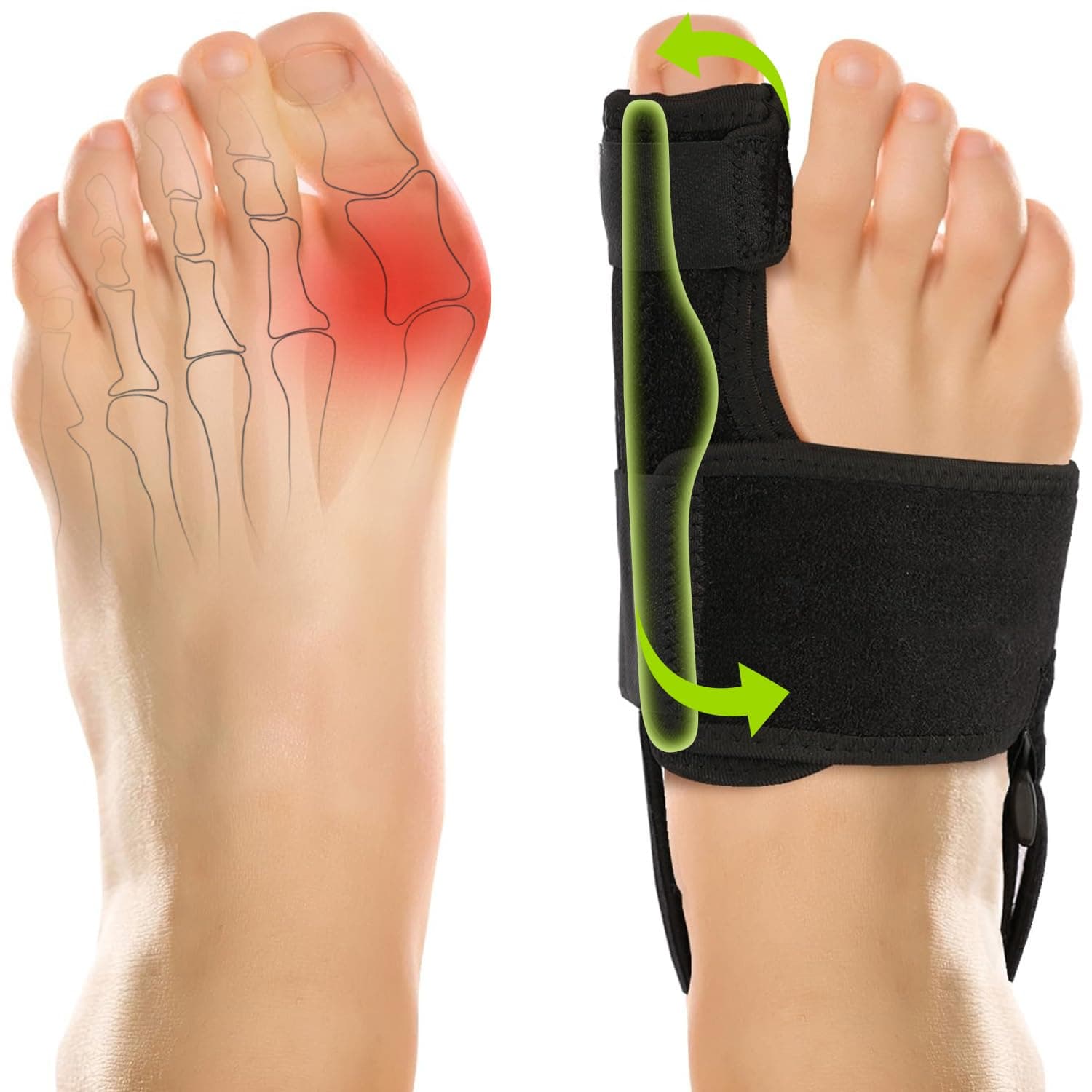 Bunion Corrector für Frauen und Männer: Orthopädische Ballenzwinge - Großzehenrichter - Nicht-chirurgische Korrektur des Hallux Valgus für Tages-/Nachtstütze (2 Stück) schwarz1