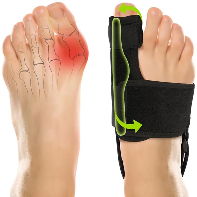 Bunion Corrector für Frauen und Männer: Orthopädische Ballenzwinge - Großzehenrichter - Nicht-chirurgische Korrektur des Hallux Valgus für Tages-/Nachtstütze (2 Stück) schwarz1