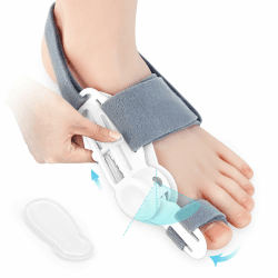 Epessa Bunion Corrector Hallux Valgus Korrektur Upgrade Verstellbare Schiene Befestigungswinkeln Hallux Valgus Schiene für Zehen Tag und Nacht für Männer und Frauen