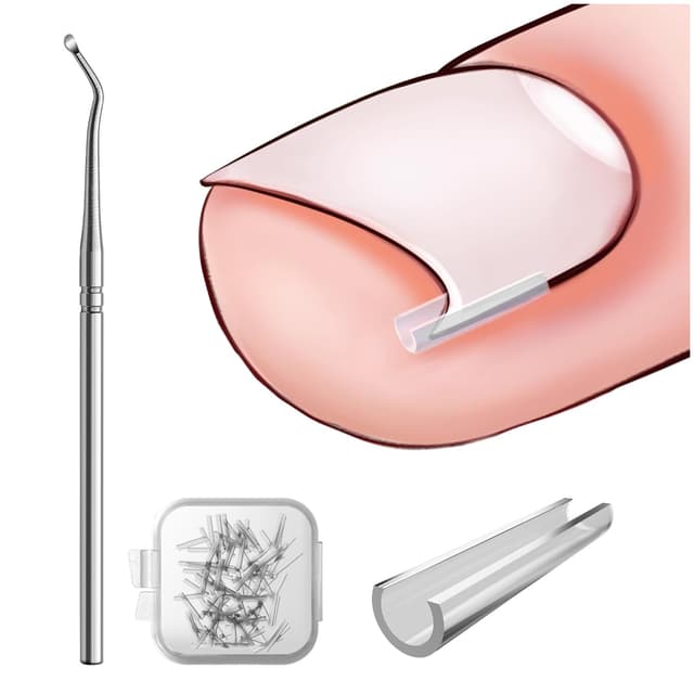 BEZOX Set zur Korrektur eingewachsener Zehennägel - 40 Stück schmerzfreie Zehennagelglättungsstreifen mit Zehennagelheber - einfaches Werkzeugset für eingewachsene Zehennägel silber