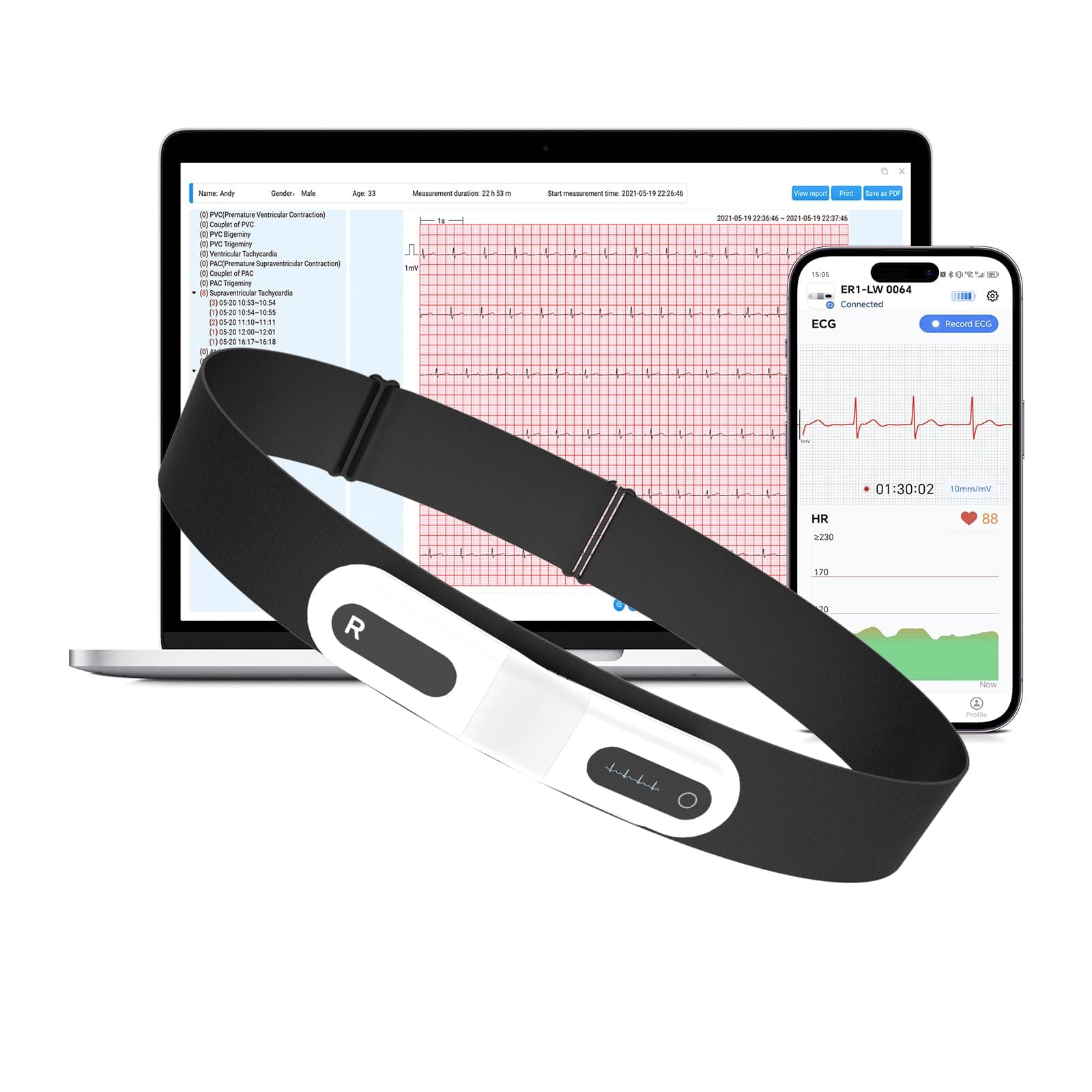 CheckMe ER1-LW 72 Stunden Langzeit-EKG Gerät mit AI-Analyse | EKG Gerät für Zuhause, EKG-Ereignismarker-Funktion, App & PC-Software, Kompatibel mit Allgemeine Elektrodenpads Angebot bei HelloDeals